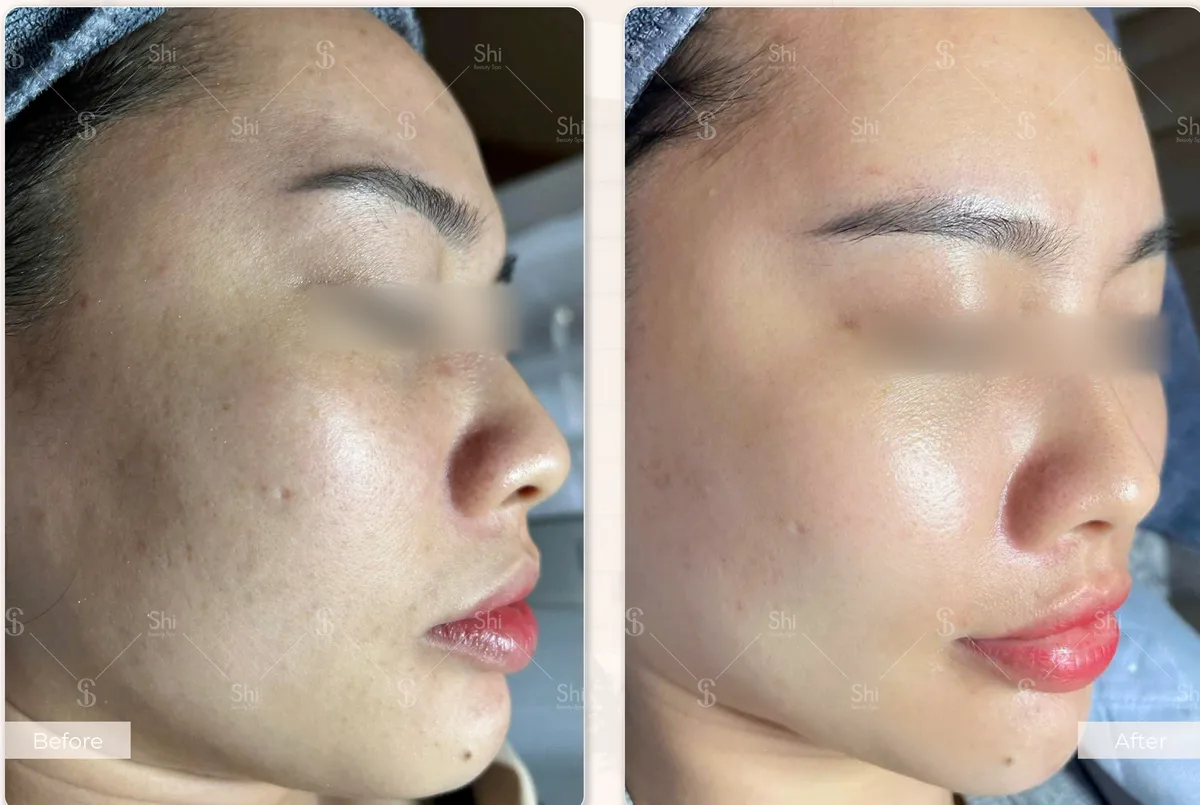 Trước và sau: Glossy Therapy