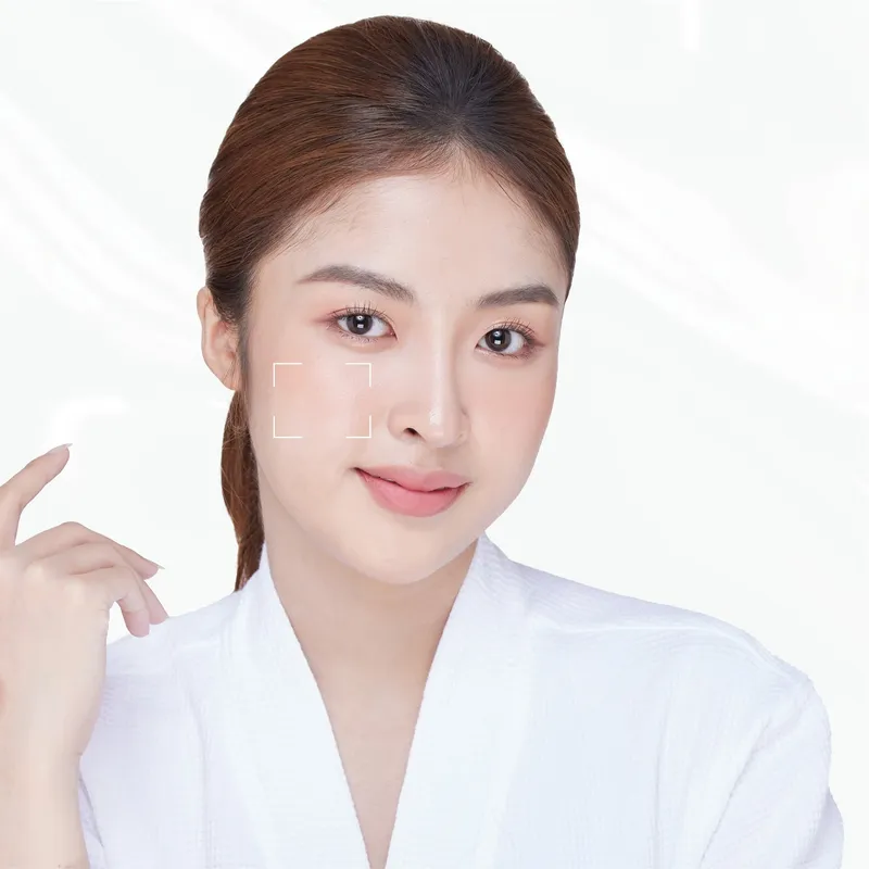 Khung soi da trên gò má, minh hoạ bước soi da trước khi lên phác đồ